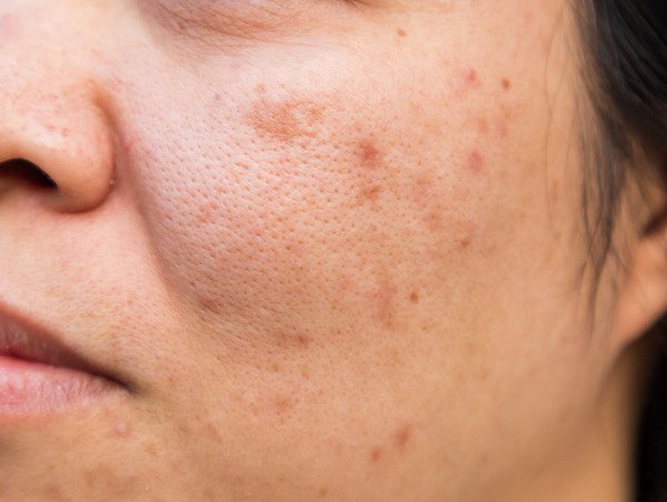 Rutina Niacinamide